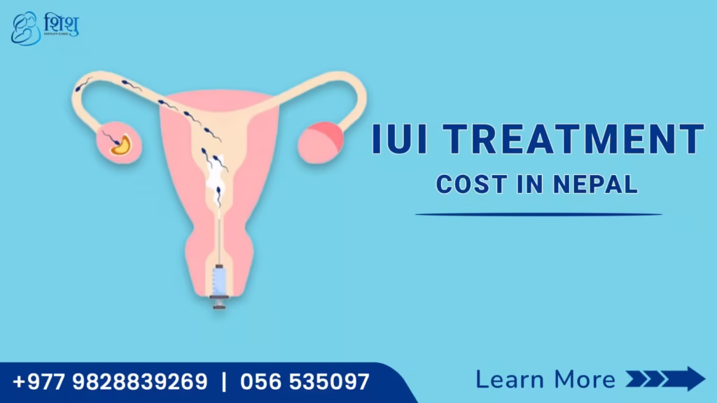 IUI Treatment Cost In Nepal
