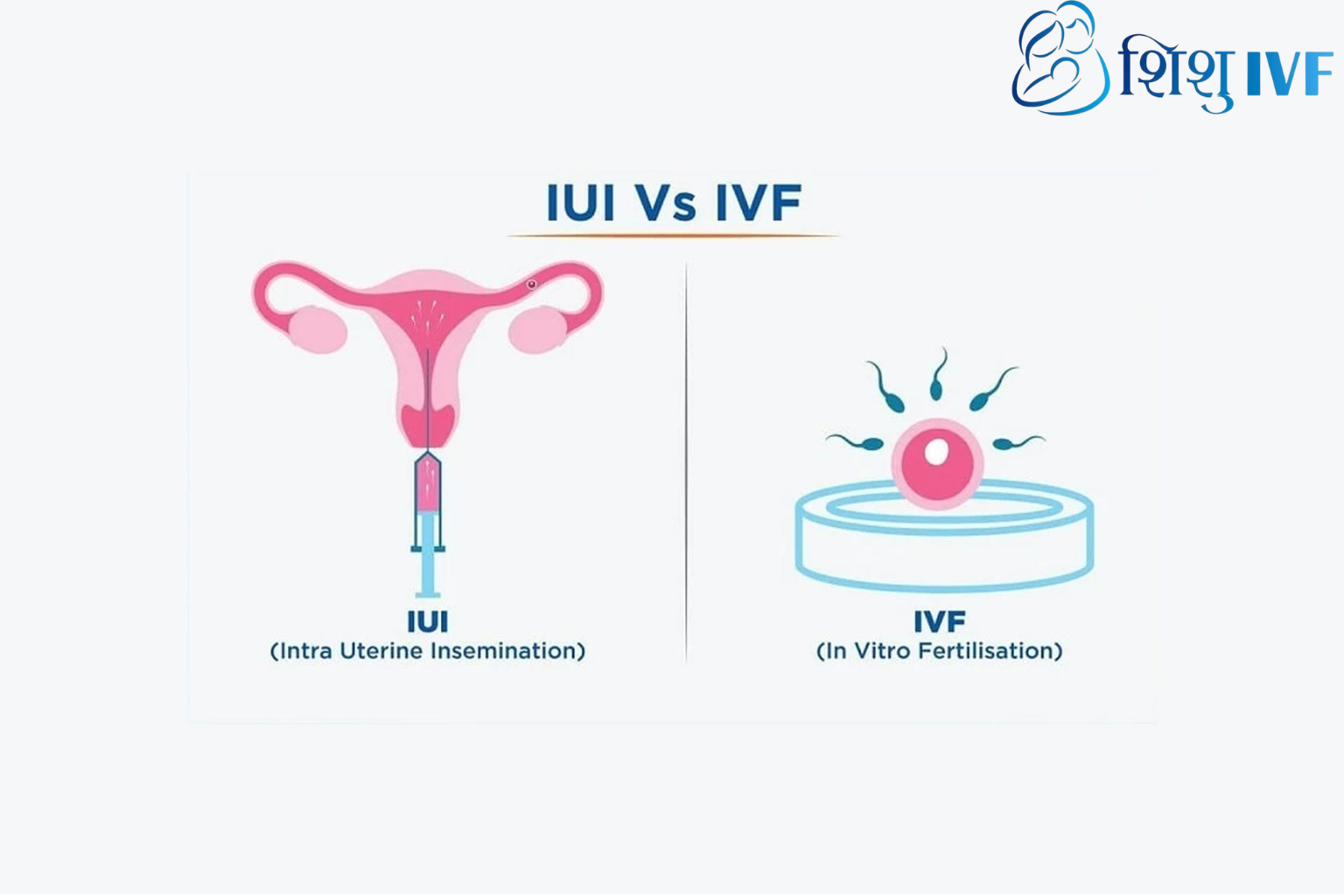 IVF vs IUI in Nepal